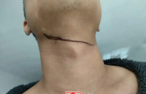 男子夜晚騎車回小區(qū)遭晾衣繩割喉 物業(yè)回應(yīng)尚未找到拴繩人